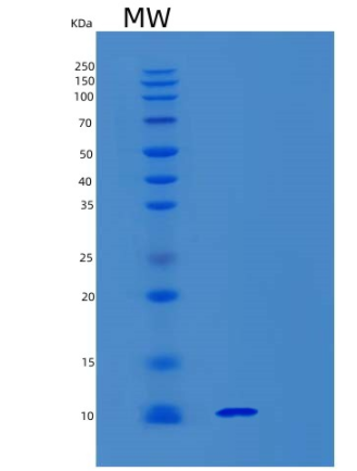 Recombinant Human Synaptobrevin 1 Protein,Recombinant Human Synaptobrevin 1 Protein