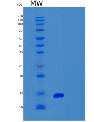 Recombinant Human Synaptobrevin 2 Protein,Recombinant Human Synaptobrevin 2 Protein