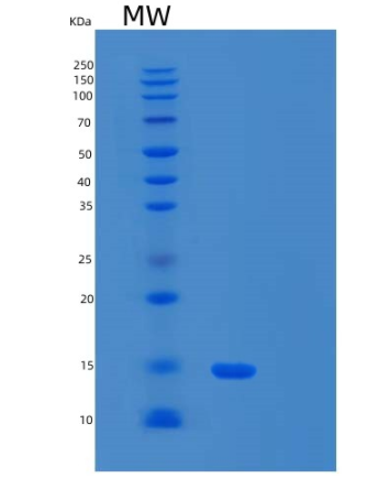 Recombinant Human α-Synuclein A30P Protein,Recombinant Human α-Synuclein A30P Protein