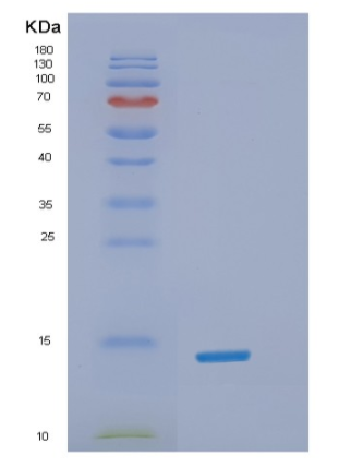 Recombinant Human α-Synuclein Protein,Recombinant Human α-Synuclein Protein