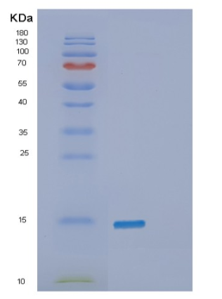 Recombinant Human β-Synuclein Protein,Recombinant Human β-Synuclein Protein