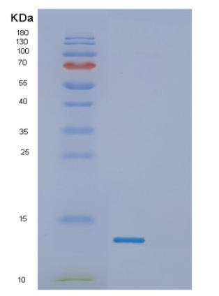 Recombinant Human γ-Synuclein Protein,Recombinant Human γ-Synuclein Protein