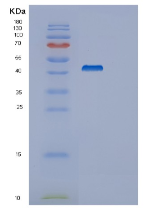 Recombinant Human SYT4 Protein,Recombinant Human SYT4 Protein