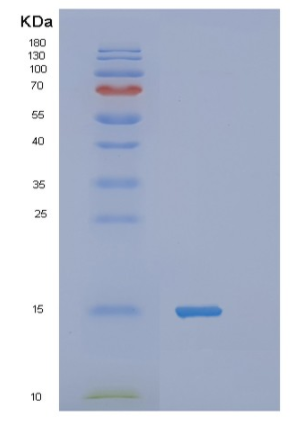 Recombinant Human TAC1 Protein,Recombinant Human TAC1 Protein