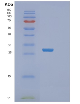 Recombinant Human TACO1 Protein,Recombinant Human TACO1 Protein