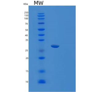 Recombinant Human SRSF1 Protein,Recombinant Human SRSF1 Protein