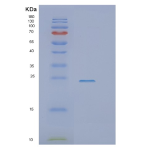 Recombinant Human SSR1 Protein,Recombinant Human SSR1 Protein