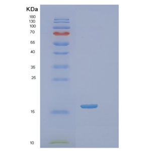 Recombinant Human SSR2 Protein,Recombinant Human SSR2 Protein