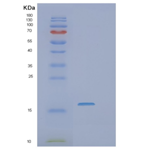 Recombinant Human SSR4 Protein,Recombinant Human SSR4 Protein