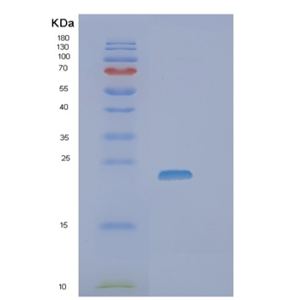 Recombinant Human SSSCA1 Protein