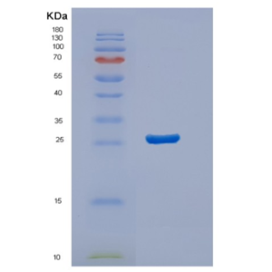 Recombinant Human STARD5 Protein,Recombinant Human STARD5 Protein