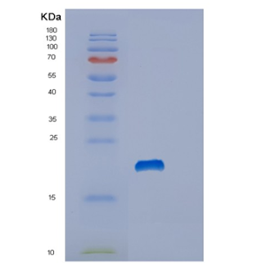 Recombinant Human Stathmin Protein