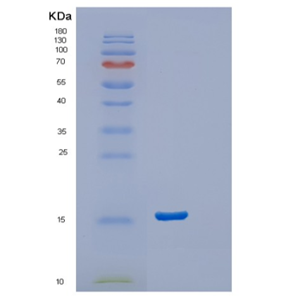 Recombinant Human Stathmin-2 Protein