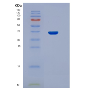 Recombinant Human STBD1 Protein,Recombinant Human STBD1 Protein