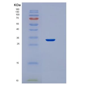 Recombinant Human STC2 Protein
