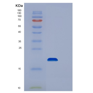 Recombinant Human STEAP4 Protein
