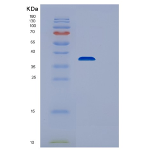 Recombinant Human STIM1 Protein,Recombinant Human STIM1 Protein