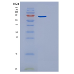 Recombinant Human STIP1 Protein