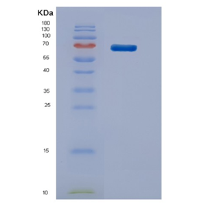 Recombinant Mouse Stip1 Protein