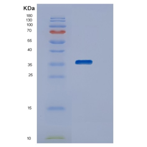 Recombinant Human STK16 Protein,Recombinant Human STK16 Protein