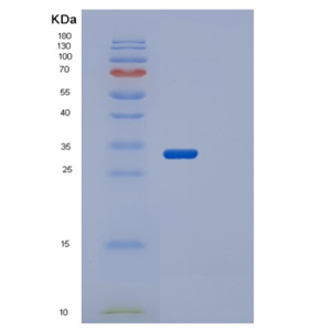 Recombinant Human STK17A Protein,Recombinant Human STK17A Protein