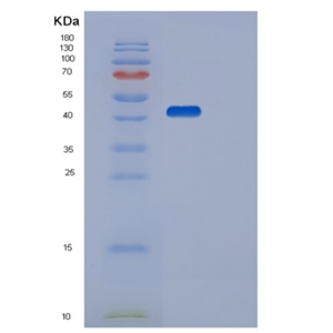 Recombinant Human STK17B Protein