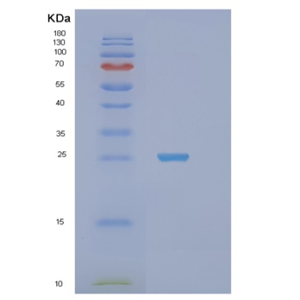 Recombinant Human STXBP6 Protein,Recombinant Human STXBP6 Protein