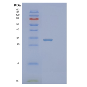 Recombinant Human STYX Protein,Recombinant Human STYX Protein