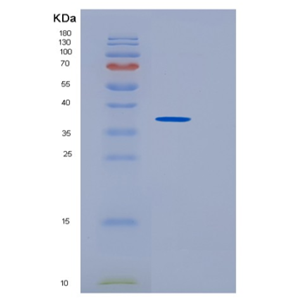 Recombinant Human SULT1B1 Protein,Recombinant Human SULT1B1 Protein