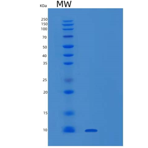 Recombinant Human SUMO-2 Protein,Recombinant Human SUMO-2 Protein