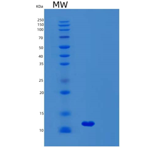 Recombinant Human SYCE3 Protein,Recombinant Human SYCE3 Protein