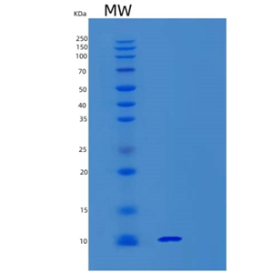 Recombinant Human Synaptobrevin 1 Protein,Recombinant Human Synaptobrevin 1 Protein