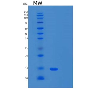 Recombinant Human α-Synuclein A30P Protein,Recombinant Human α-Synuclein A30P Protein