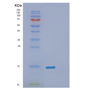 Recombinant Human β-Synuclein Protein