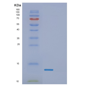 Recombinant Human γ-Synuclein Protein