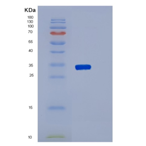 Recombinant Human SYT1 Protein