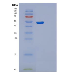 Recombinant Human SYT11 Protein,Recombinant Human SYT11 Protein
