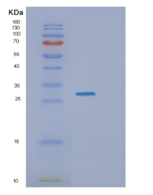 Recombinant Human TBCB Protein,Recombinant Human TBCB Protein