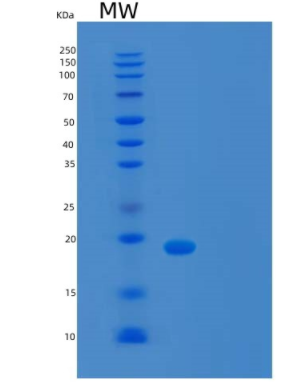 Recombinant Human TCEAL1 Protein,Recombinant Human TCEAL1 Protein