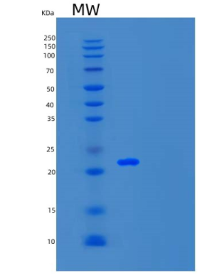 Recombinant Human TEN1 Protein,Recombinant Human TEN1 Protein