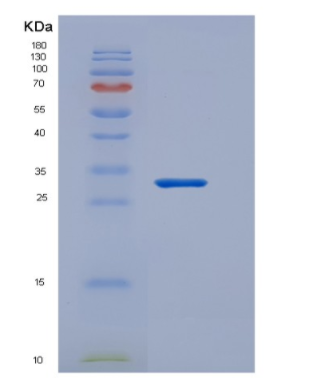 Recombinant Transcription Factor A, Mitochondrial (TFAM),Recombinant Transcription Factor A, Mitochondrial (TFAM)