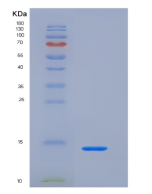 Recombinant Trefoil Factor 1 (TFF1),Recombinant Trefoil Factor 1 (TFF1)