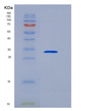 Recombinant Transferrin Receptor (TFR),Recombinant Transferrin Receptor (TFR)