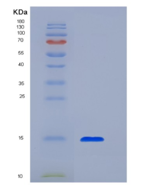 Recombinant Transforming Growth Factor Beta 1 (TGFb1),Recombinant Transforming Growth Factor Beta 1 (TGFb1)