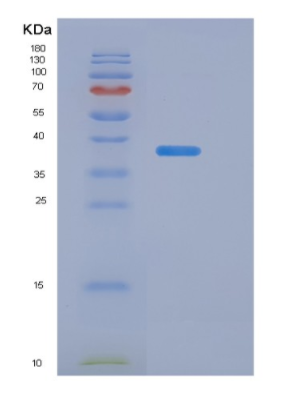 Recombinant Transforming Growth Factor Beta 3 (TGFb3),Recombinant Transforming Growth Factor Beta 3 (TGFb3)