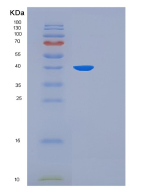 Recombinant Human THPO Protein,Recombinant Human THPO Protein