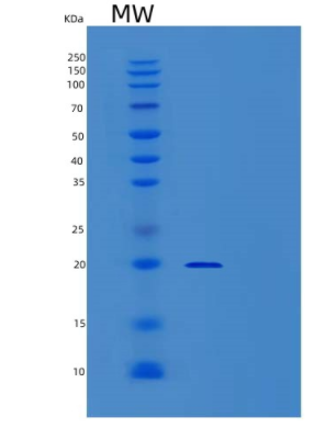 Recombinant Human TMED10 Protein,Recombinant Human TMED10 Protein