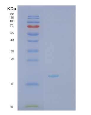 Recombinant Human TNF Protein,Recombinant Human TNF Protein