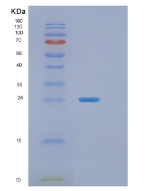 Recombinant Human TNFAIP8 Protein,Recombinant Human TNFAIP8 Protein