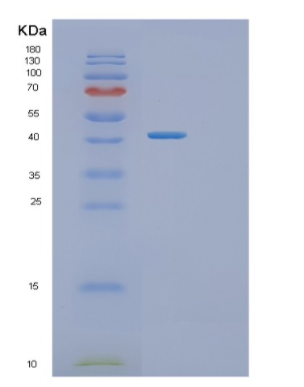 Recombinant Human TMOD3 Protein,Recombinant Human TMOD3 Protein